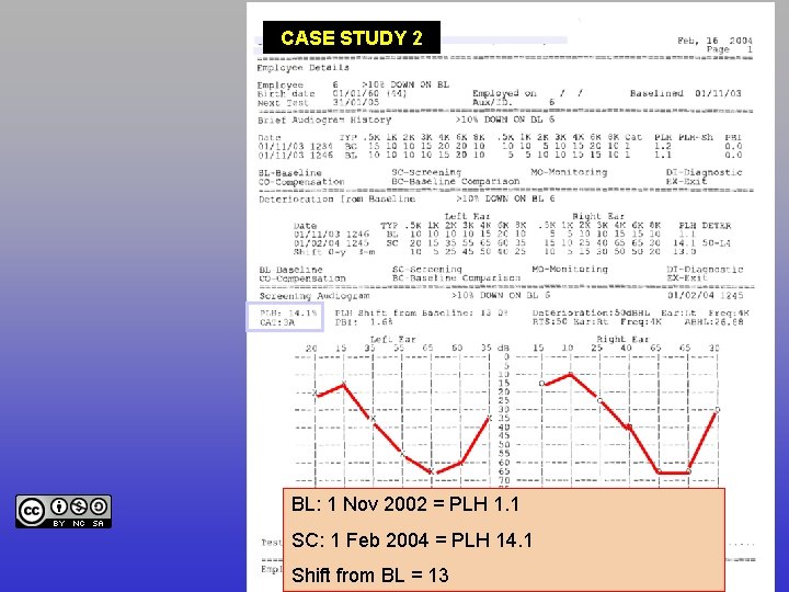 CASE STUDY 2 BL: 1 Nov 2002 = PLH 1. 1 SC: 1 Feb