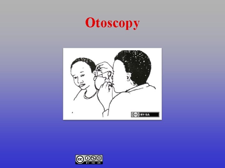 Otoscopy 