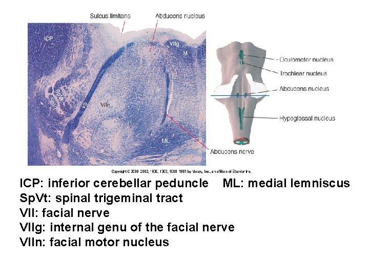 ICP: inferior cerebellar peduncle ML: medial lemniscus Sp. Vt: spinal trigeminal tract VII: facial