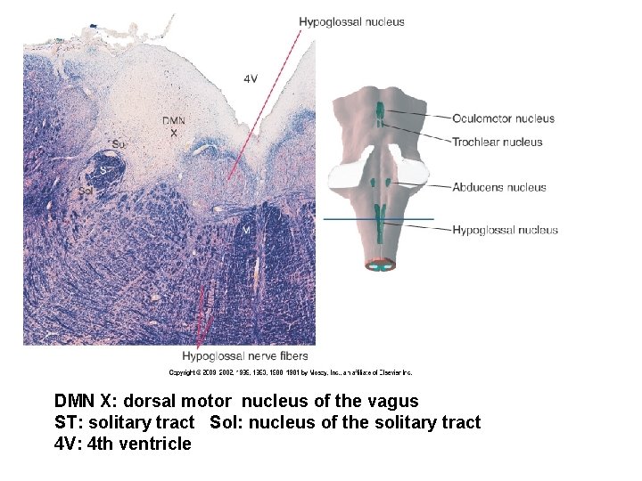 DMN X: dorsal motor nucleus of the vagus ST: solitary tract Sol: nucleus of