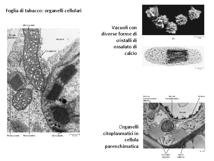 Foglia di tabacco: organelli cellulari Vacuoli con diverse forme di cristalli di ossalato di