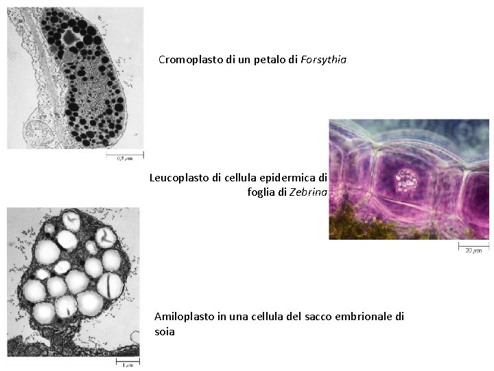 Cromoplasto di un petalo di Forsythia Leucoplasto di cellula epidermica di foglia di Zebrina