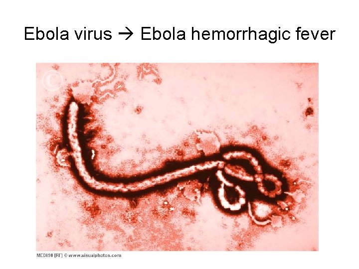 Ebola virus Ebola hemorrhagic fever 