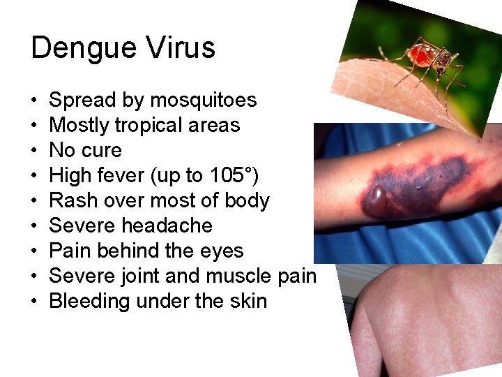 Dengue Virus • • • Spread by mosquitoes Mostly tropical areas No cure High
