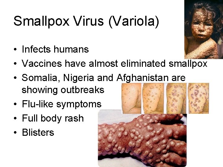 Smallpox Virus (Variola) • Infects humans • Vaccines have almost eliminated smallpox • Somalia,