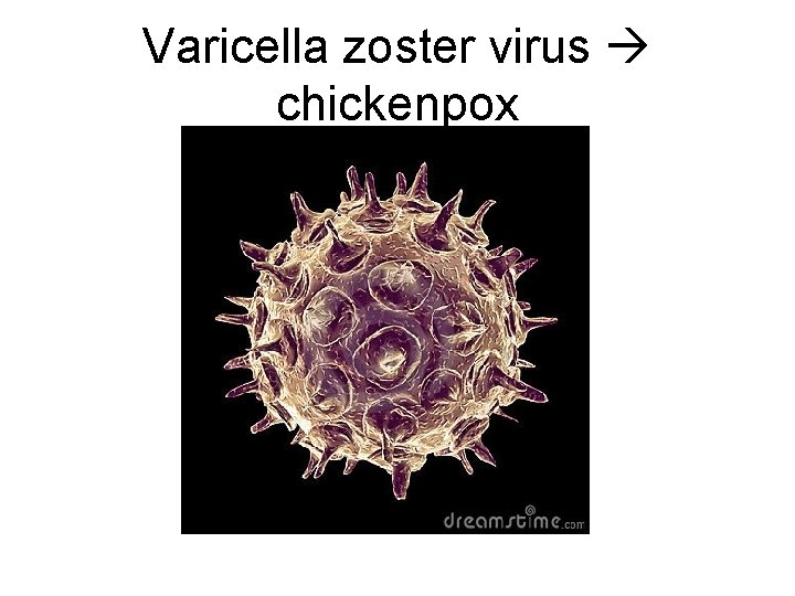 Varicella zoster virus chickenpox 