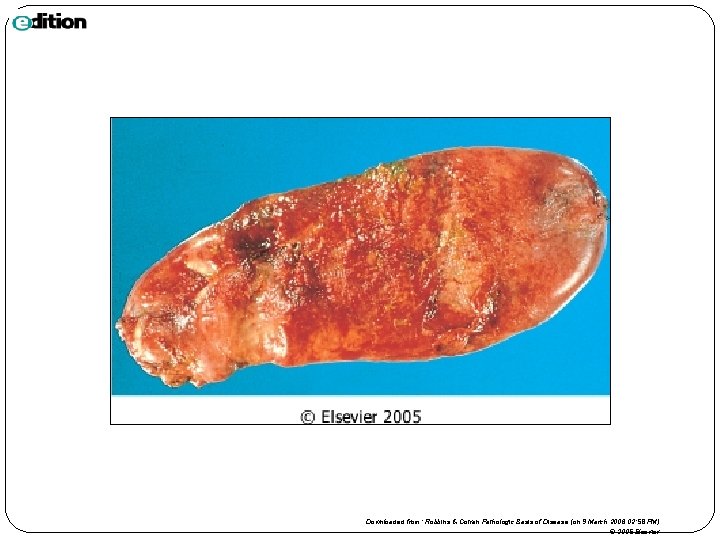 Downloaded from: Robbins & Cotran Pathologic Basis of Disease (on 9 March 2006 02: