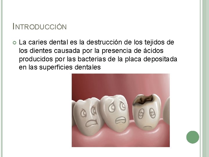 INTRODUCCIÓN La caries dental es la destrucción de los tejidos de los dientes causada