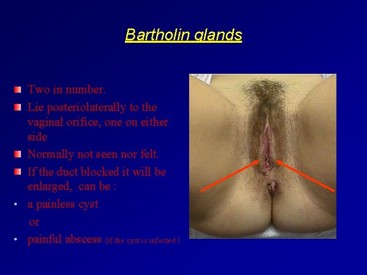 Bartholin glands Two in number. Lie posteriolaterally to the vaginal orifice, one on either