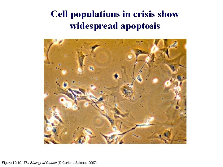 Cell populations in crisis show widespread apoptosis Figure 10. 10 The Biology of Cancer