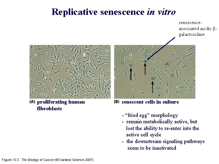 Replicative senescence in vitro senescenceassociated acidic βgalactosidase proliferating human fibroblasts senescent cells in culture