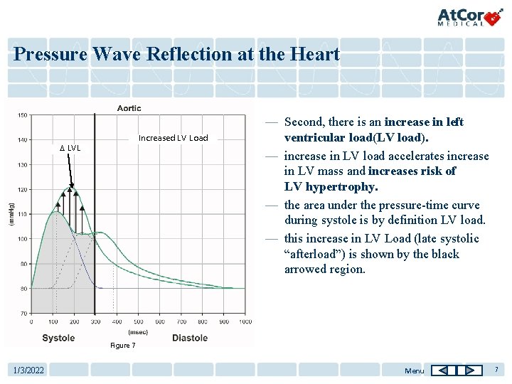 Pressure Wave Reflection at the Heart Increased LV Load D LVL — Second, there