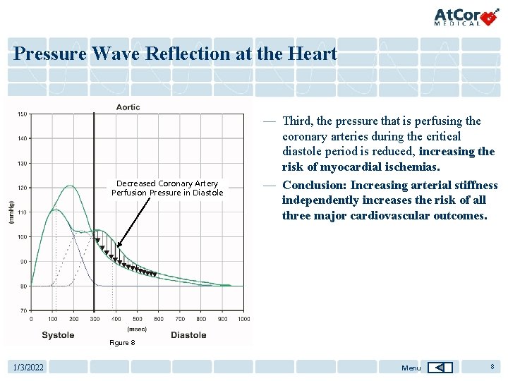 Pressure Wave Reflection at the Heart Decreased Coronary Artery Perfusion Pressure in Diastole —