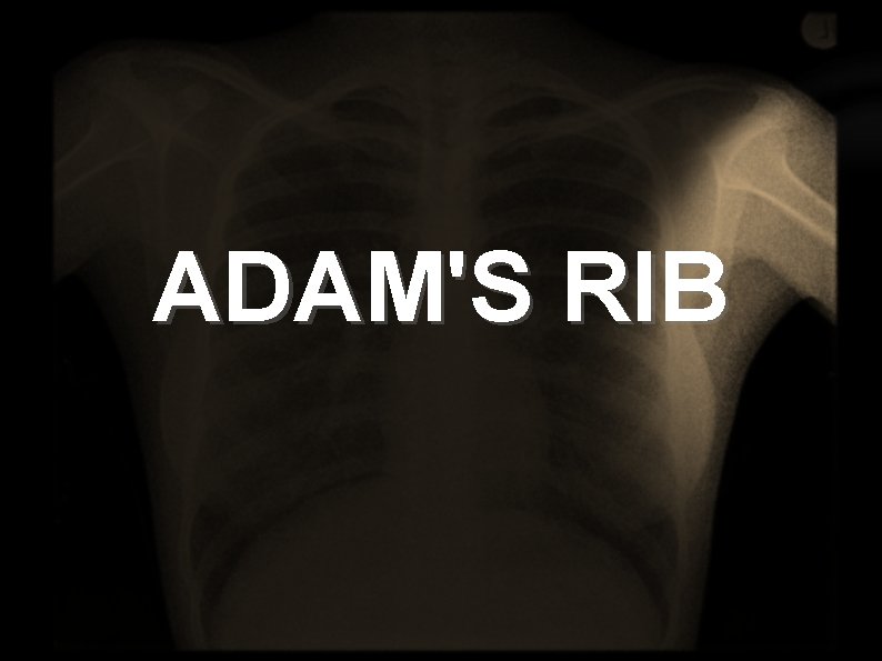 ADAM'S RIB 