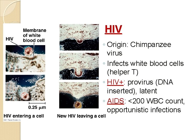 HIV ◦ Origin: Chimpanzee virus ◦ Infects white blood cells (helper T) ◦ HIV+: