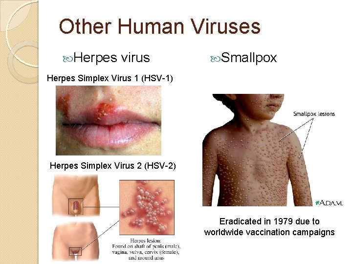 Other Human Viruses Herpes virus Smallpox Herpes Simplex Virus 1 (HSV-1) Herpes Simplex Virus