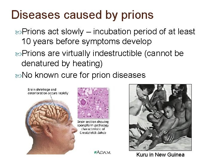 Diseases caused by prions Prions act slowly – incubation period of at least 10