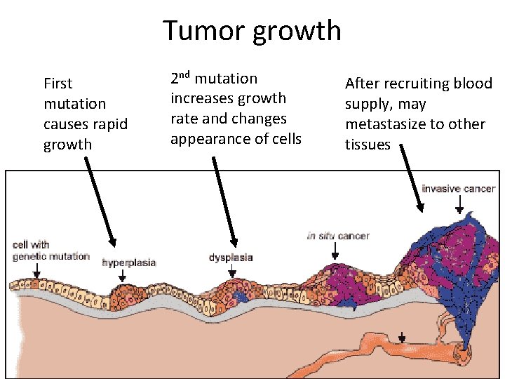 Tumor growth First mutation causes rapid growth 2 nd mutation increases growth rate and