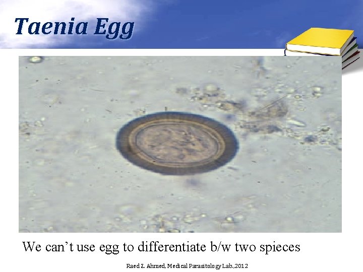 Taenia Egg We can’t use egg to differentiate b/w two spieces Raed Z. Ahmed,