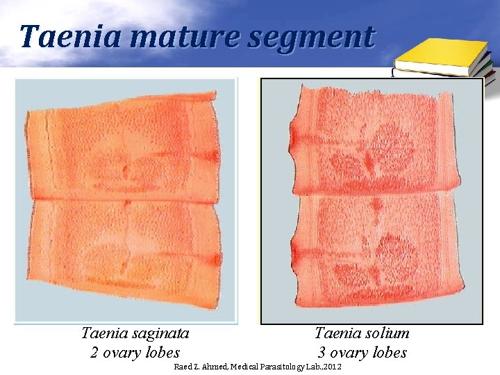 Taenia mature segment Taenia saginata 2 ovary lobes Taenia solium 3 ovary lobes Raed