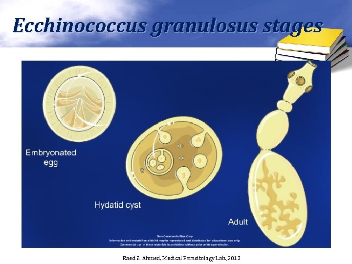 Ecchinococcus granulosus stages Raed Z. Ahmed, Medical Parasitology Lab. , 2012 
