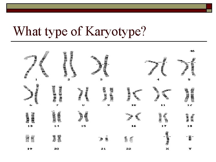 What type of Karyotype? 