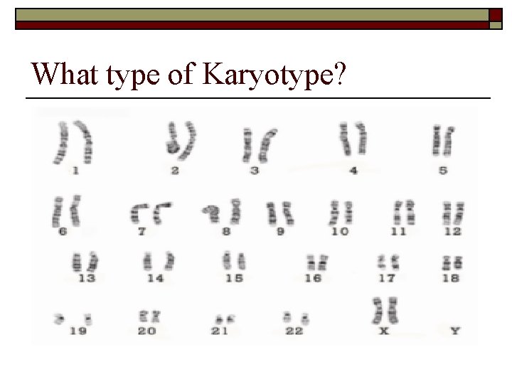 What type of Karyotype? 