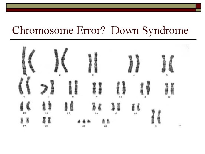 Chromosome Error? Down Syndrome 