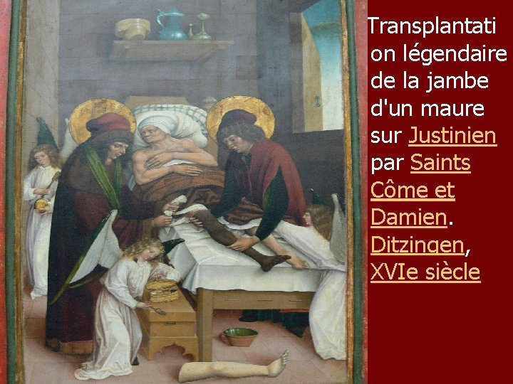 Transplantati on légendaire de la jambe d'un maure sur Justinien par Saints Côme et