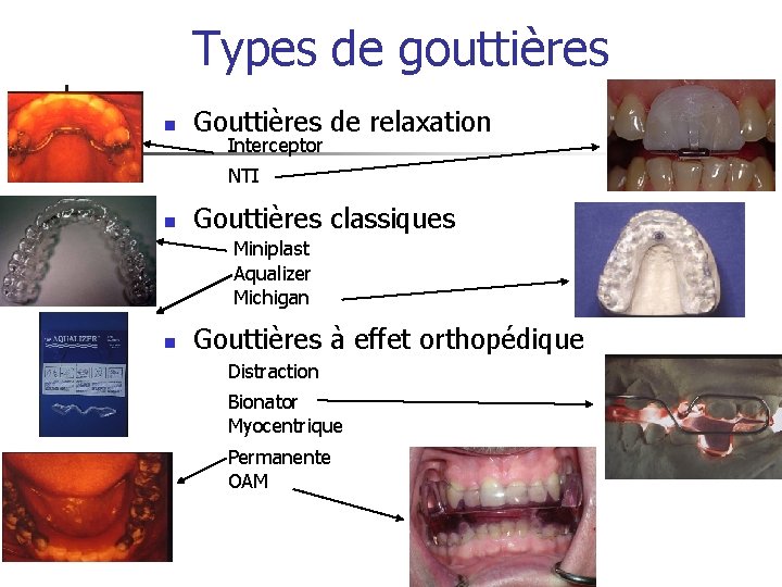Types de gouttières n Gouttières de relaxation Interceptor NTI n Gouttières classiques Miniplast Aqualizer