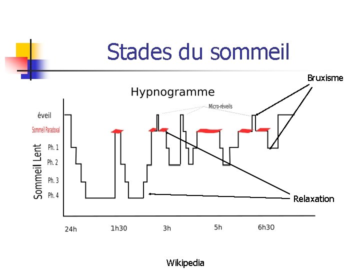 Stades du sommeil Bruxisme Relaxation Wikipedia 