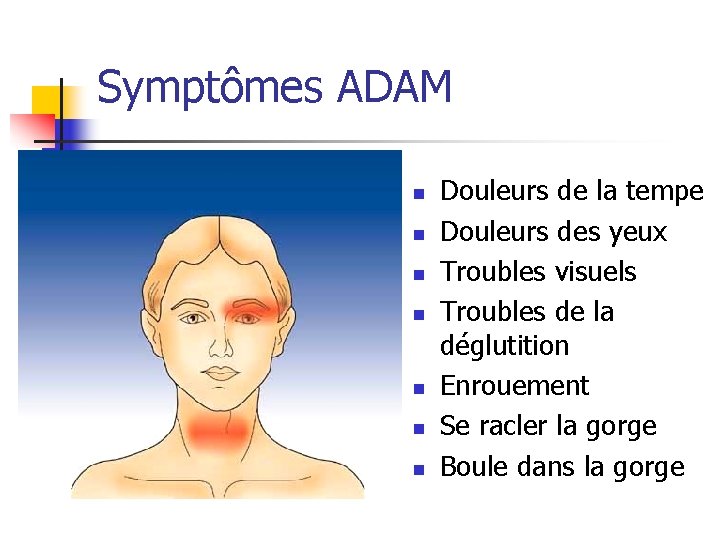 Symptômes ADAM n n n n Douleurs de la tempe Douleurs des yeux Troubles