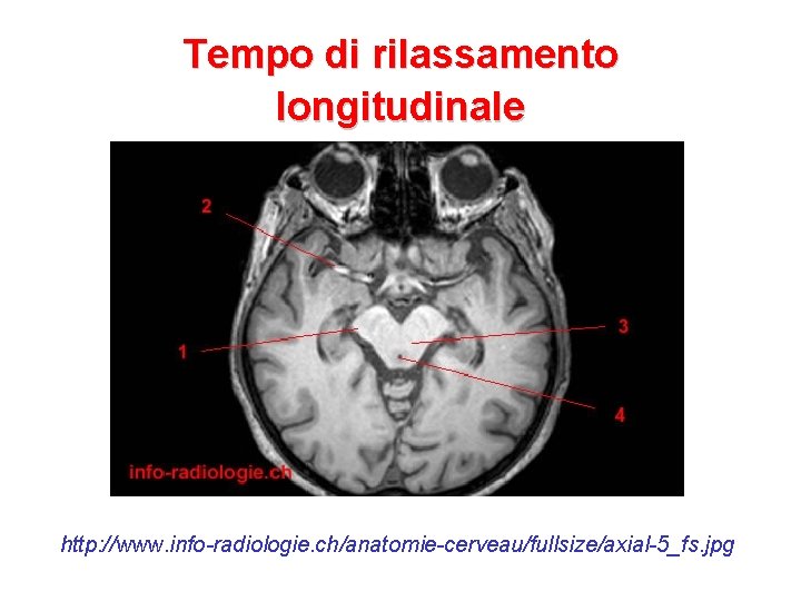 Tempo di rilassamento longitudinale http: //www. info-radiologie. ch/anatomie-cerveau/fullsize/axial-5_fs. jpg 