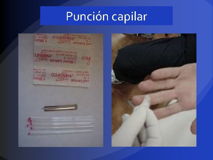 Punción capilar 