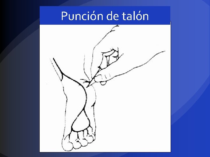 Punción de talón 