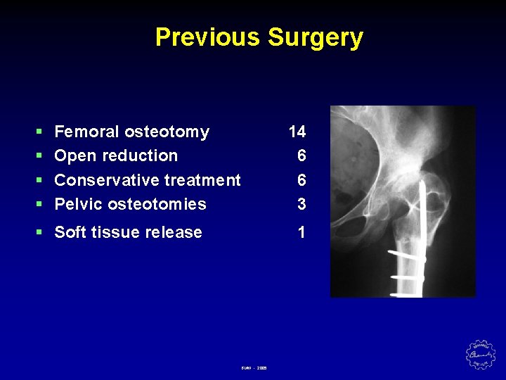 Previous Surgery § § Femoral osteotomy Open reduction Conservative treatment Pelvic osteotomies § Soft
