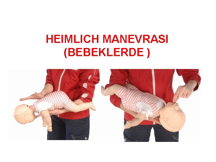 HEIMLICH MANEVRASI (BEBEKLERDE ) 