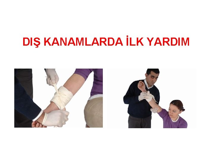 DIŞ KANAMLARDA İLK YARDIM 