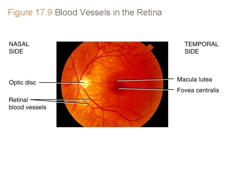 Figure 17. 9 Blood Vessels in the Retina Figure 17. 9 Blood Vessels in the Retina