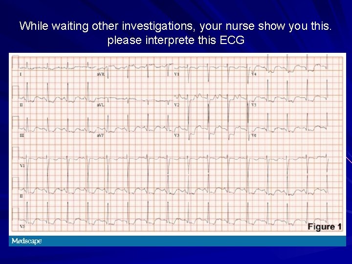 While waiting other investigations, your nurse show you this. please interprete this ECG 