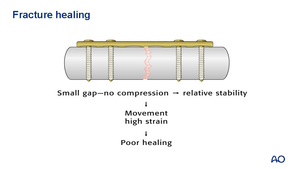 Fracture healing 