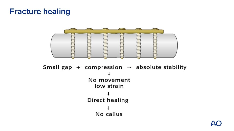 Fracture healing 