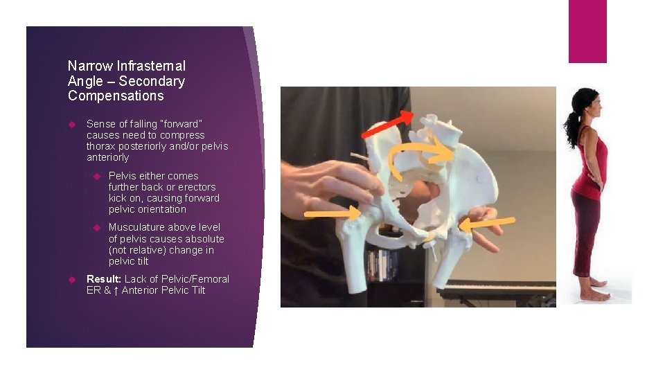 Narrow Infrasternal Angle – Secondary Compensations Sense of falling “forward” causes need to compress