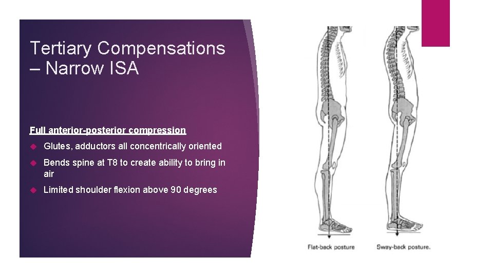 Tertiary Compensations – Narrow ISA Full anterior-posterior compression Glutes, adductors all concentrically oriented Bends