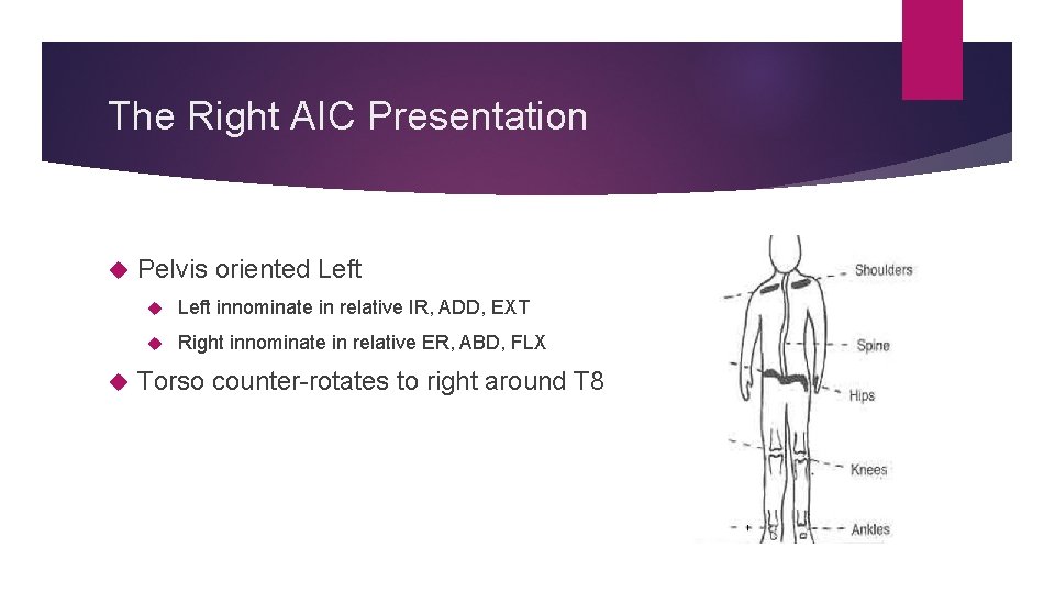 The Right AIC Presentation Pelvis oriented Left innominate in relative IR, ADD, EXT Right