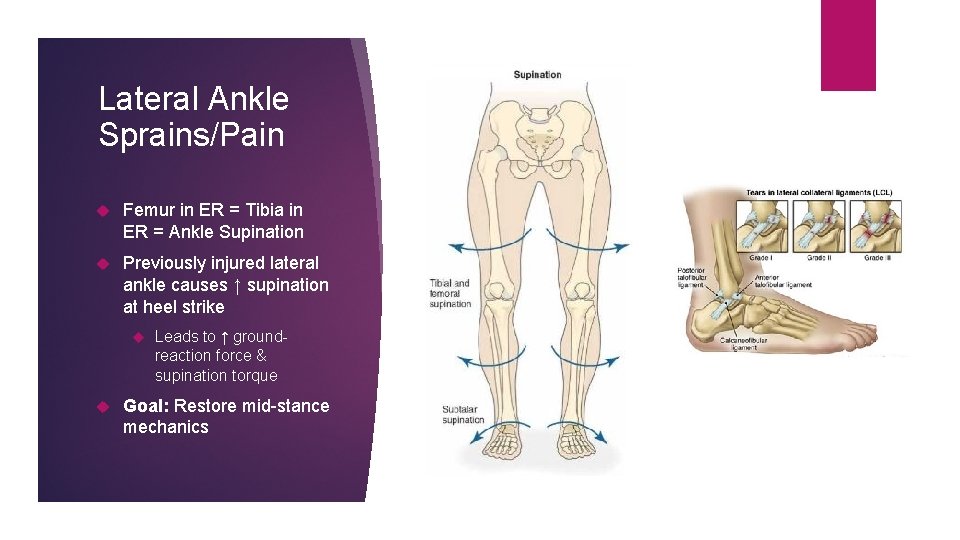 Lateral Ankle Sprains/Pain Femur in ER = Tibia in ER = Ankle Supination Previously