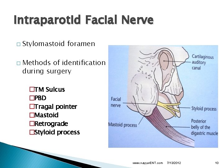 Intraparotid Facial Nerve � � Stylomastoid foramen Methods of identification during surgery �TM Sulcus