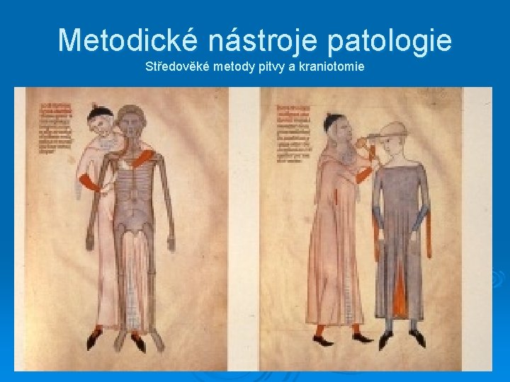 Metodické nástroje patologie Středověké metody pitvy a kraniotomie 