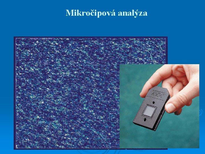 Mikročipová analýza 