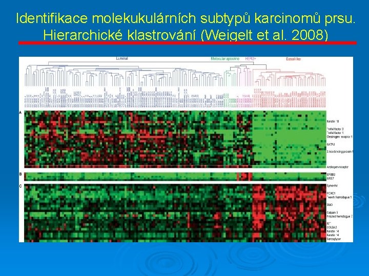 Identifikace molekukulárních subtypů karcinomů prsu. Hierarchické klastrování (Weigelt et al. 2008) 